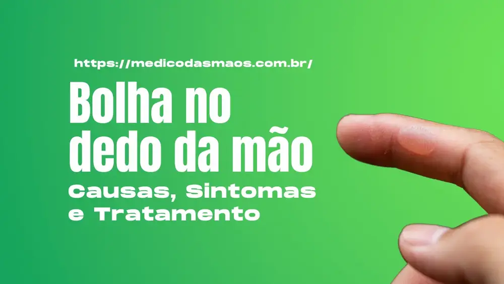 Bolha no dedo da mão: causas, tratamentos e prevenção