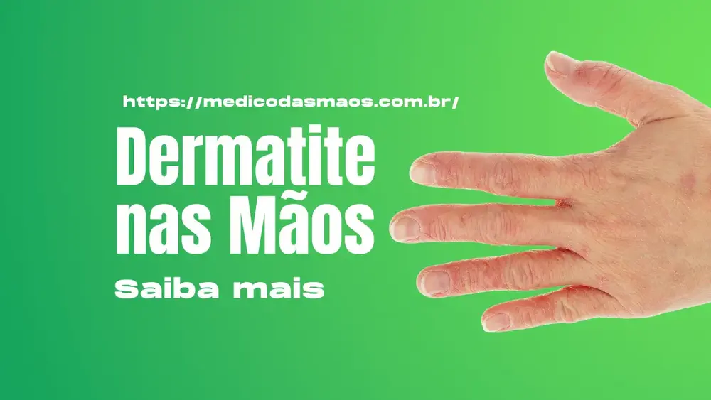 Dermatite nas Mãos: Causas, Sintomas, Tratamento e Prevenção
