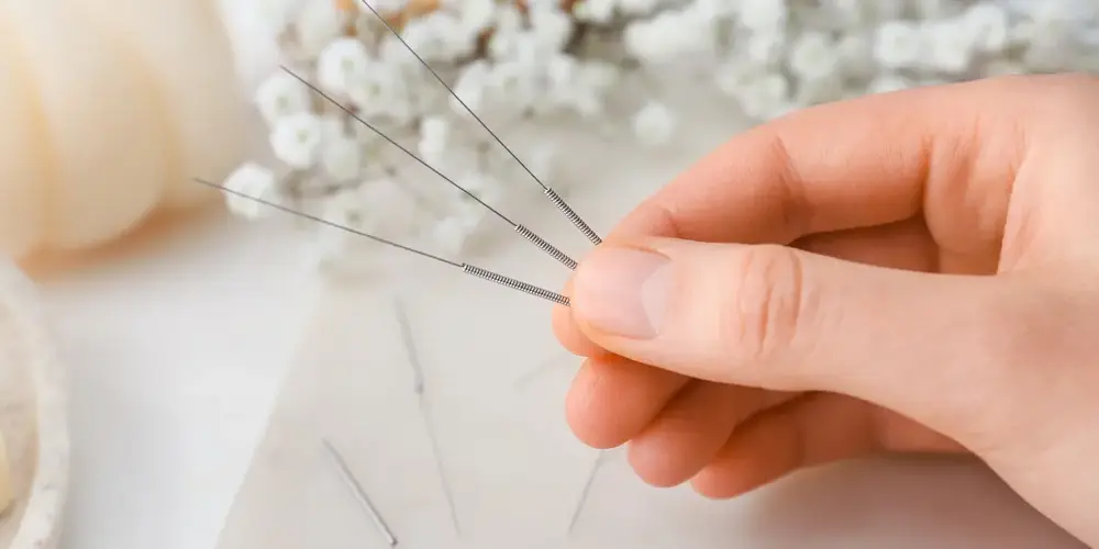 Para que serve a acupuntura na mão?