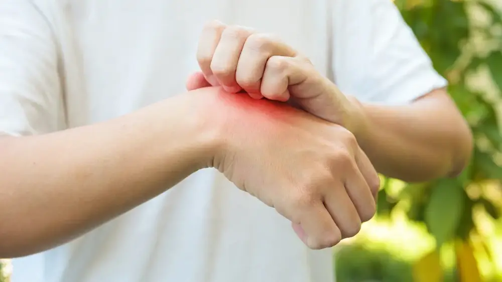 Tipos de alergia nas mãos: Causas, sintomas e tratamentos
