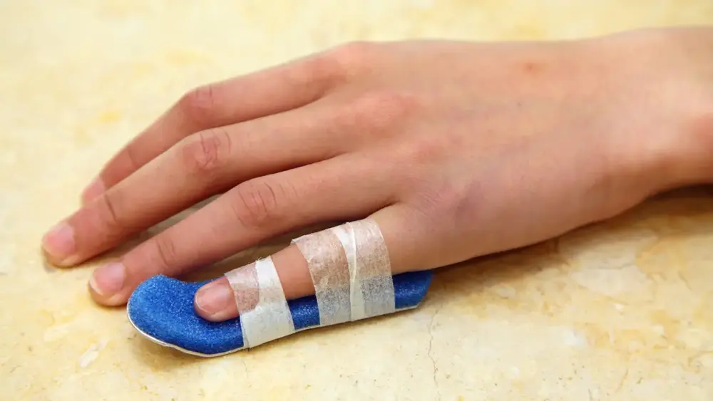 Torção no dedo da mão - Sintomas, tratamento e prevenção
