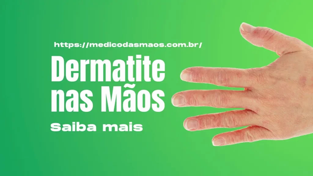 Dermatite nas Mãos Causas, Sintomas, Tratamento e Prevenção