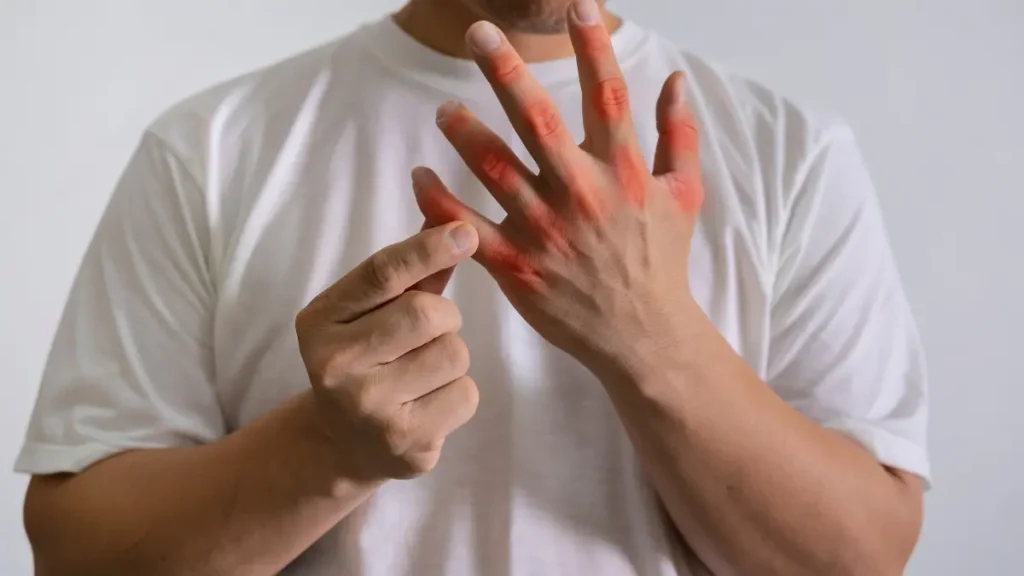 Como Tratar Dor nas Juntas dos Dedos das Mãos